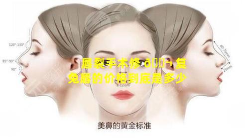 唇裂手术修 🐬 复兔唇的价格到底是多少